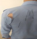 واکسیناتور اداره دامپزشکی ایذه بر اثر حمله سگ از ناحیه کتف و دست مصدوم شد