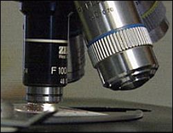 microscope-cbc